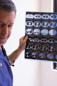 VCF Mesothelioma Claim