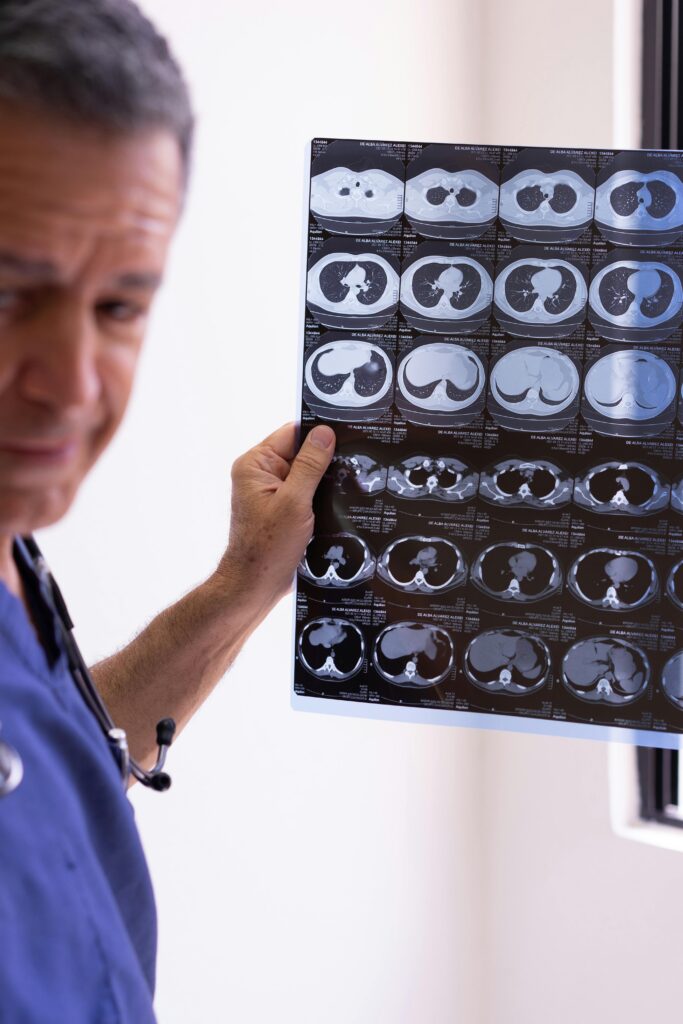 VCF Mesothelioma Claim